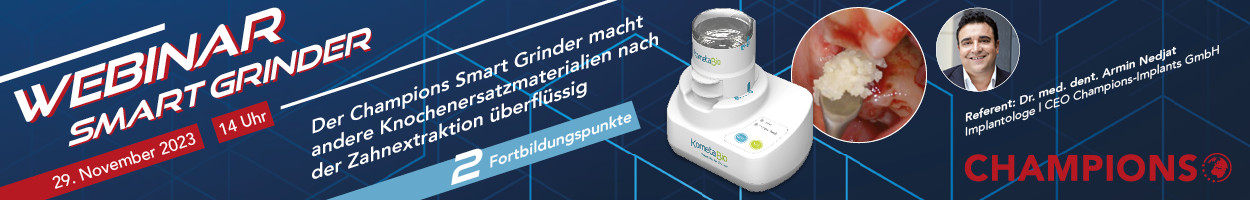 Champions Smart Grinder Webinar am 29.11.2023