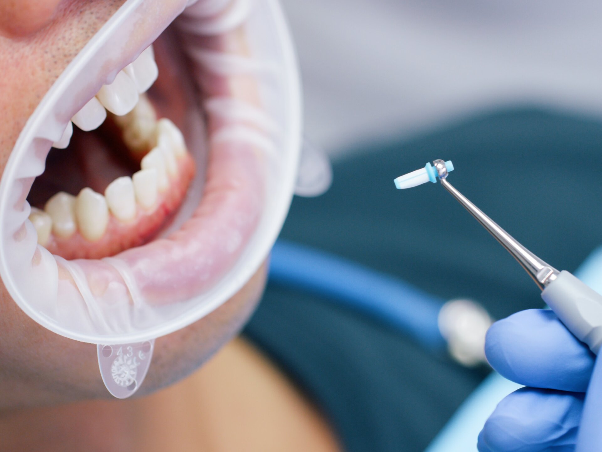 Schritt 4: Modellieren