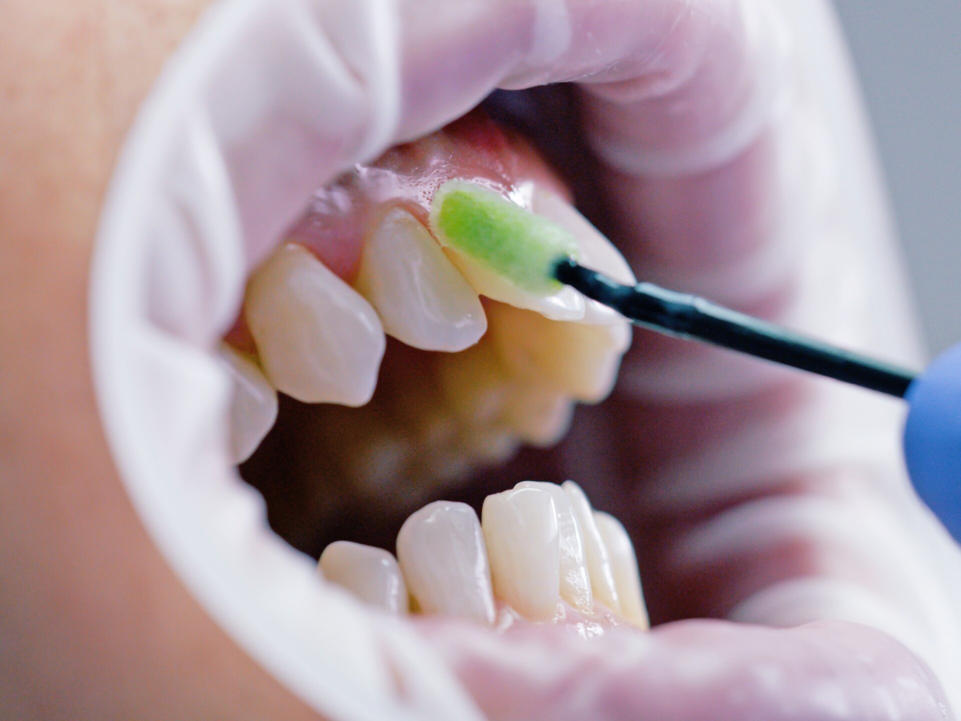 Schritt 7: Schützen