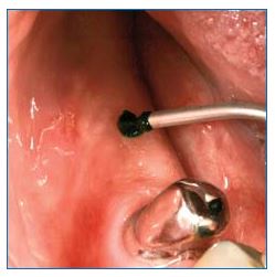 Bio-Ink_ANW2