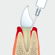 csm_Dynexan_Grafik_1_008ca028b1