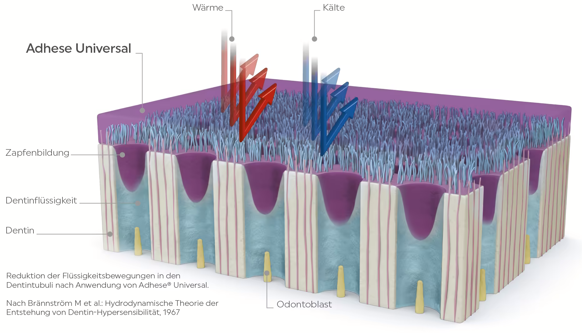 Adhese_Universal_Desensitizing_DE